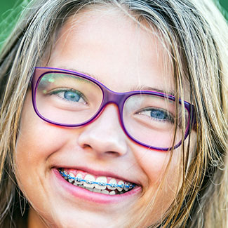 life with braces